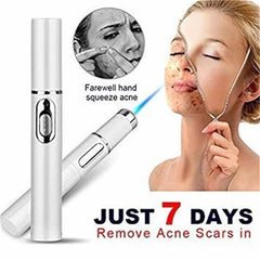 Blue Light Therapy Acne Laser Pen Soft Scar Wrinkle Removal Treatment Device Skin Care Beauty Equipment - TikTopia