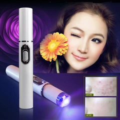 Blue Light Therapy Acne Laser Pen Soft Scar Wrinkle Removal Treatment Device Skin Care Beauty Equipment - TikTopia
