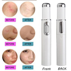 Blue Light Therapy Acne Laser Pen Soft Scar Wrinkle Removal Treatment Device Skin Care Beauty Equipment - TikTopia