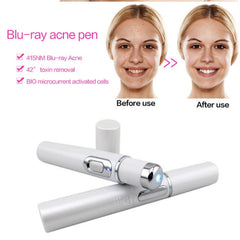 Blue Light Therapy Acne Laser Pen Soft Scar Wrinkle Removal Treatment Device Skin Care Beauty Equipment - TikTopia