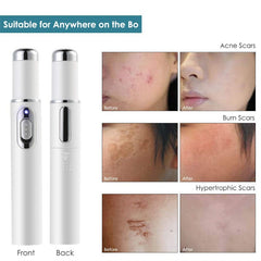 Blue Light Therapy Acne Laser Pen Soft Scar Wrinkle Removal Treatment Device Skin Care Beauty Equipment - TikTopia