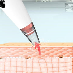 The pores clean artifact household cosmetic instrument suck black new instrument - TikTopia