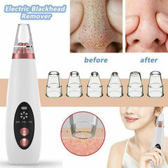 The pores clean artifact household cosmetic instrument suck black new instrument - TikTopia