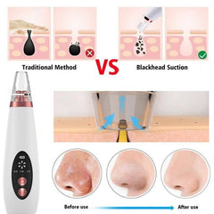 The pores clean artifact household cosmetic instrument suck black new instrument - TikTopia