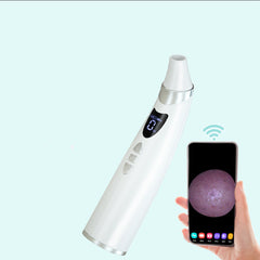 Electric Visual Blackhead Suction Instrument Household Cleansing Pore Cleaner For Skin Equipment Skin Care Tool - TikTopia