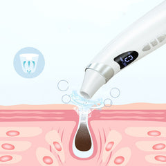 Electric Visual Blackhead Suction Instrument Household Cleansing Pore Cleaner For Skin Equipment Skin Care Tool - TikTopia